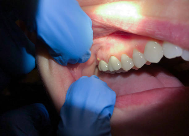 Best Chipped Tooth Repair Near Me  in Shields, MI