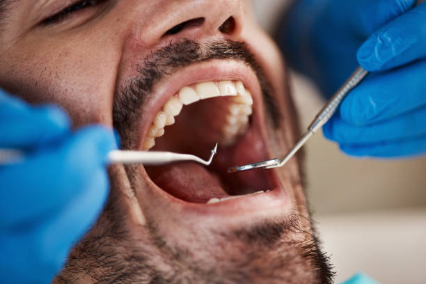 Best Emergency Tooth Extraction  in Shields, MI